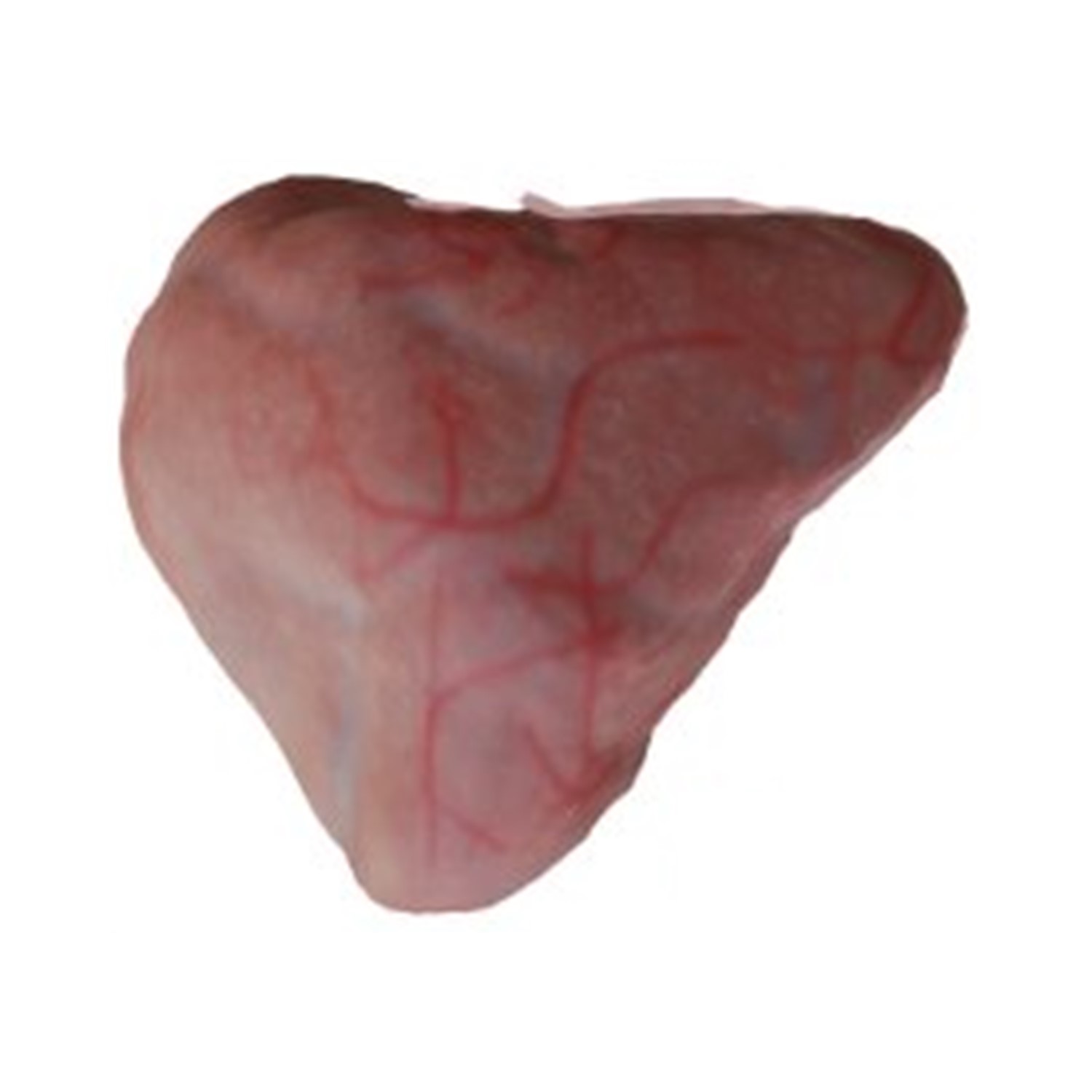 3D Virtual Bladder Reconstruction