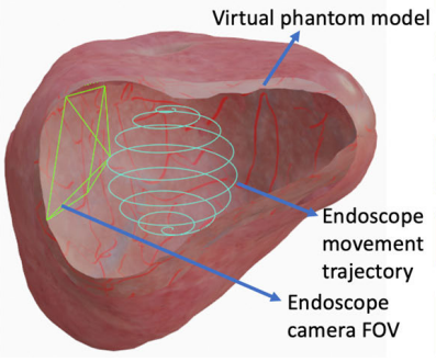 Virtual Endoscopy Simulator
